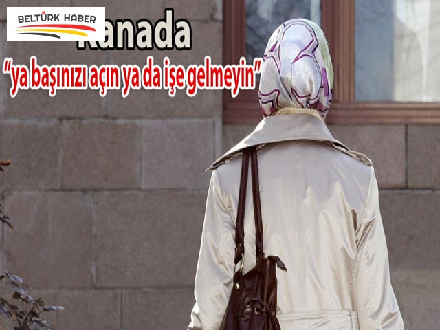 ya başınızı açın ya da işe gelmeyin