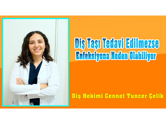 Diş Taşı Tedavi Edilmezse Enfeksiyona Neden Olabiliyor